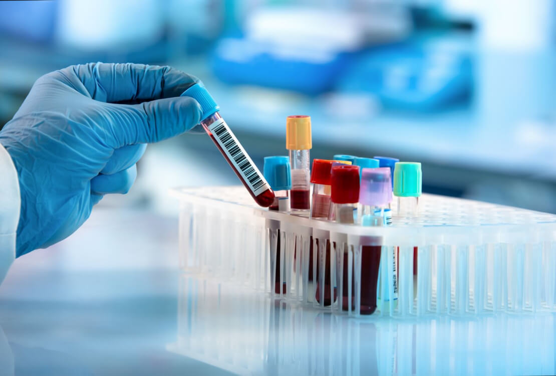 examples of research topics in medical laboratory science